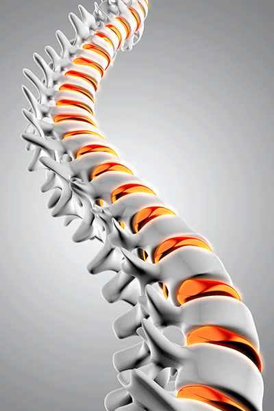 columna-vertebral-3D-tratamiento-escoliosis