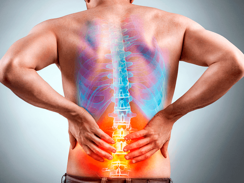 fotografía de la espalda de un hombre con lumbalgia en Fisioterapia Almeria Fernando Arco Centro de Fisioterapia