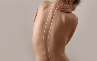 La Escoliosis Y Sus Misterios