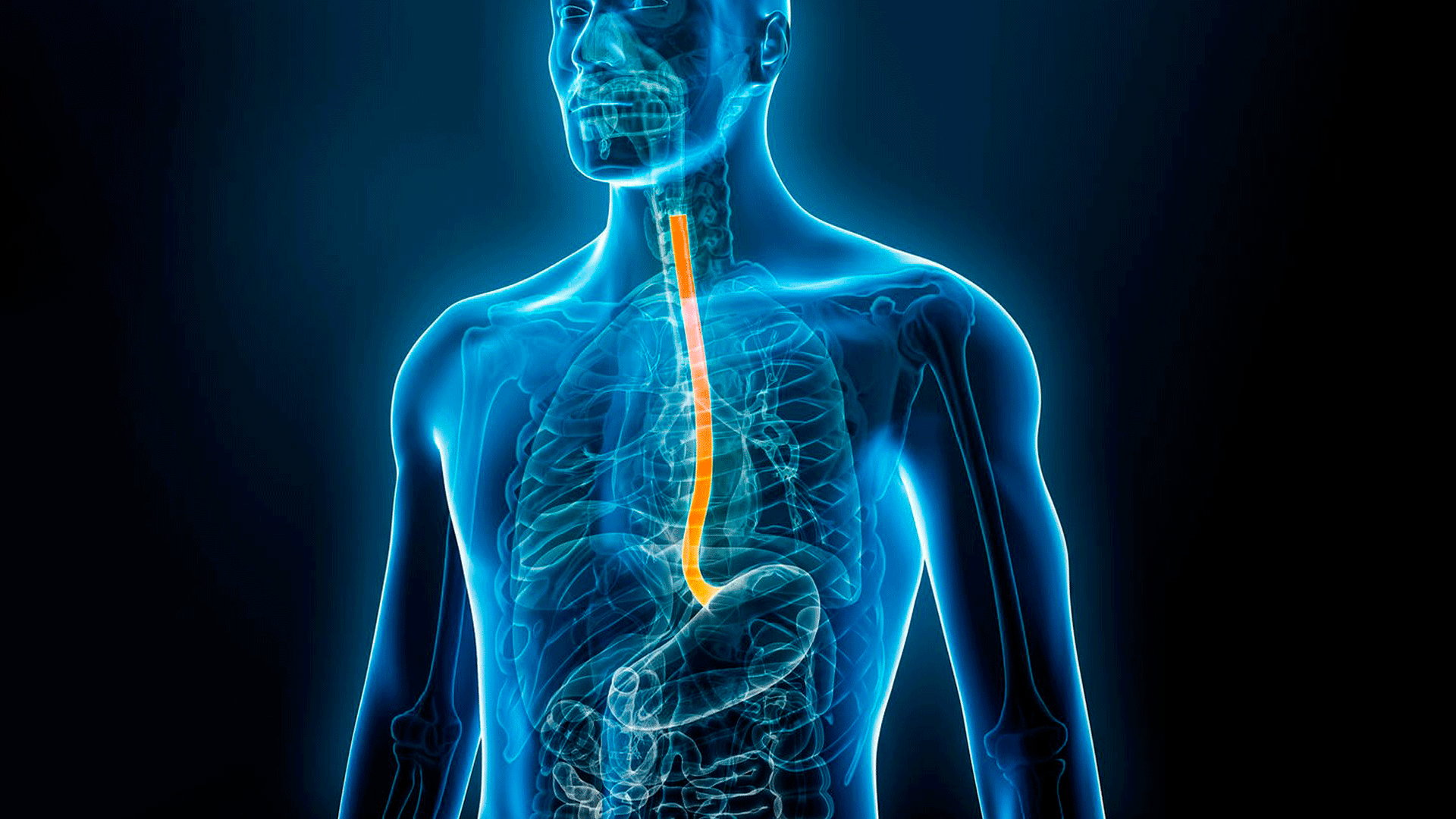 Radiografía de cuerpo humano con Reflujo Gastroesofágico en Fernando Arco Centro de Fisioterapia en Almería