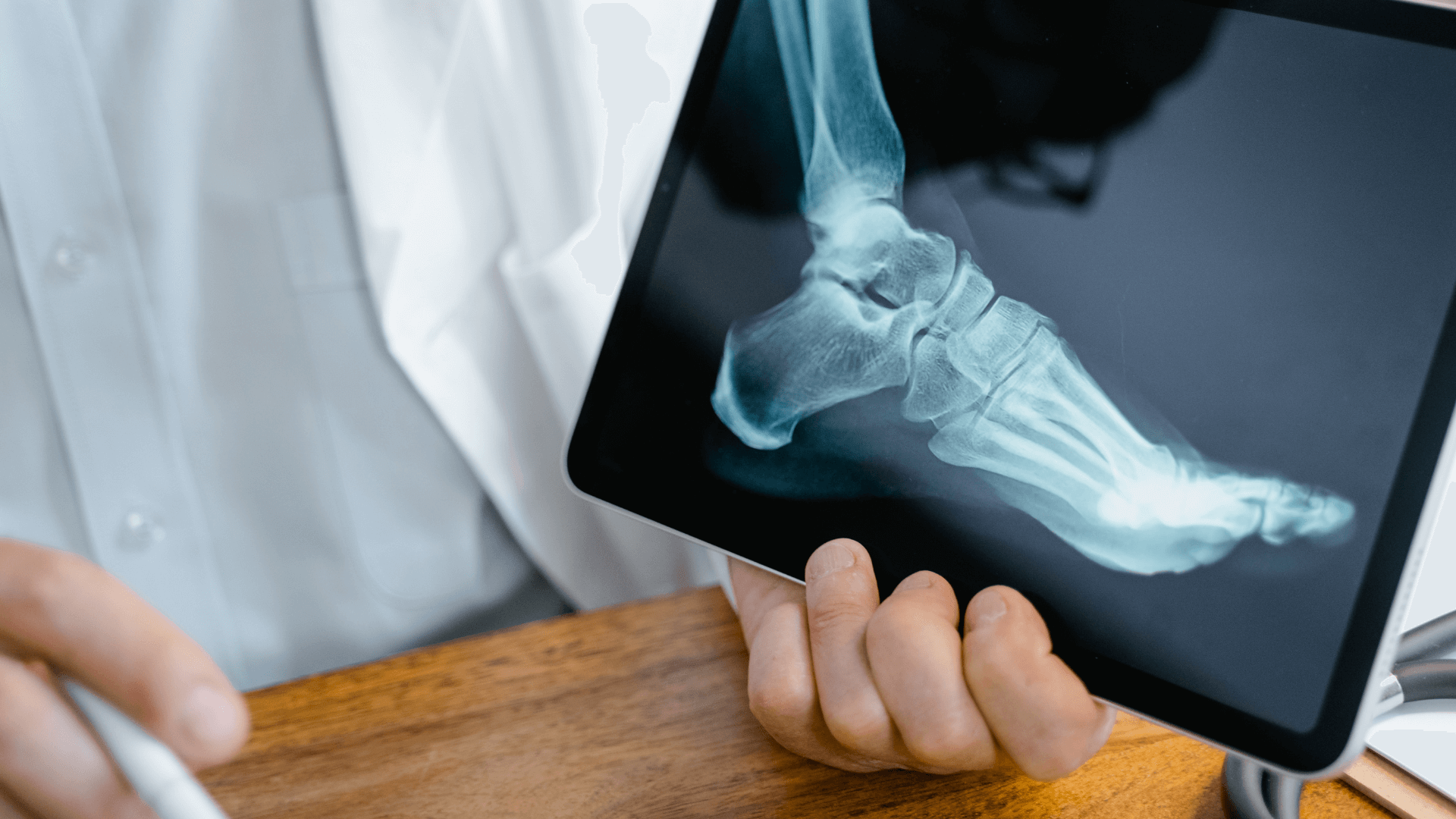 radiografia de lesión de astrágalo mostrada en tablet en Fernando Arco Centro de Fisioterapia en Almería