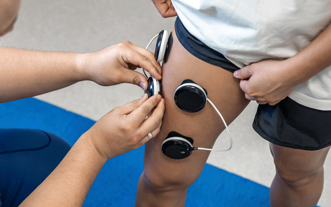 Cómo los Tens en Fisioterapia generan Estimulación Nerviosa