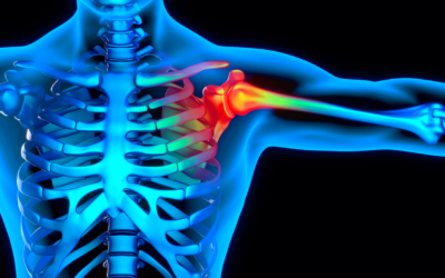 Descubre La Causa Oculta de Tu Dolor de Hombro y Cómo Solucionarlo